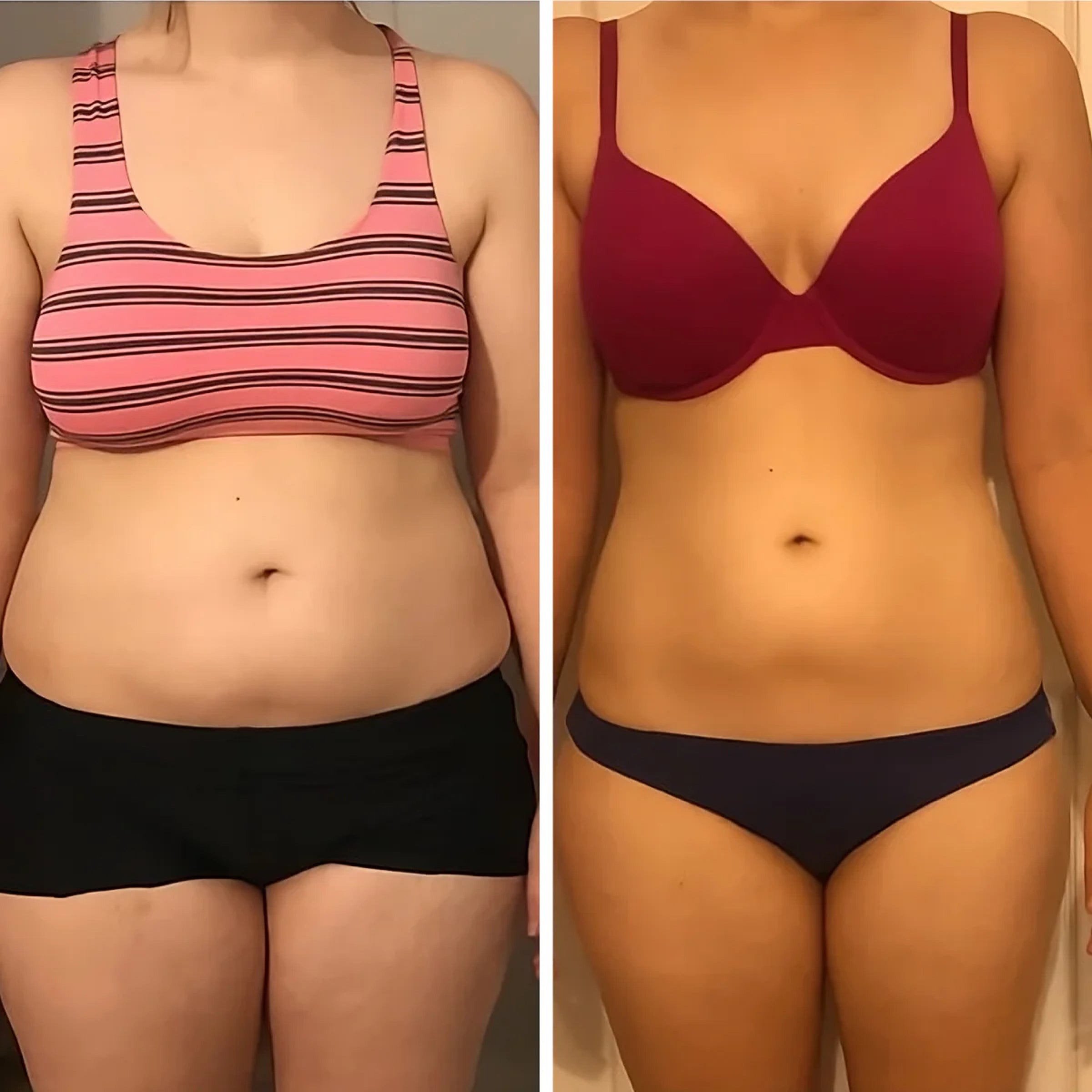 Resultados antes y después de Hot Shapers mostrando figura más estilizada